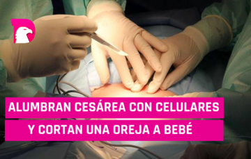  Alumbran cesárea con celulares y cortan una oreja a bebé