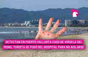  Detectan en Puerto Vallarta caso de viruela del mono, turista se fugó del hospital para no aislarse