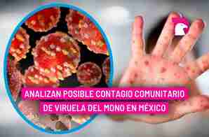  Analizan posible contagio comunitario de viruela del mono en México