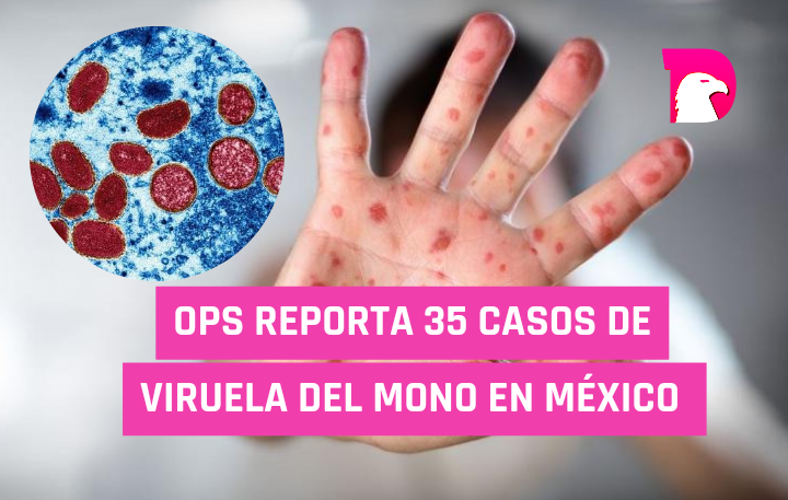  OPS reporta 35 casos de viruela del mono en México