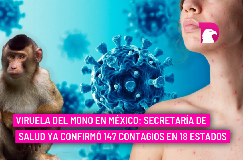  Viruela del Mono en México: Secretaría de Salud ya confirmó 147 contagios en 18 estados