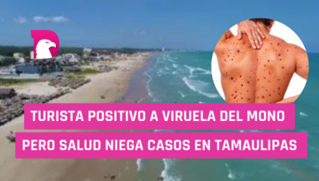  Turista positivo a viruela del mono, pero Salud niega casos en Tamaulipas