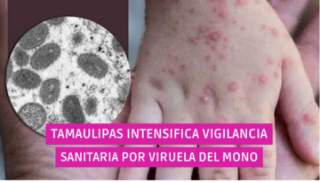  Tamaulipas intensifica vigilancia sanitaria por viruela del mono