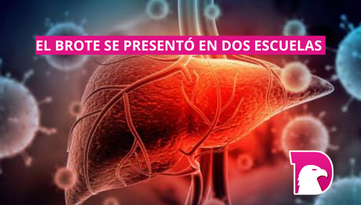  Brote de Hepatitis A sube a 8 casos