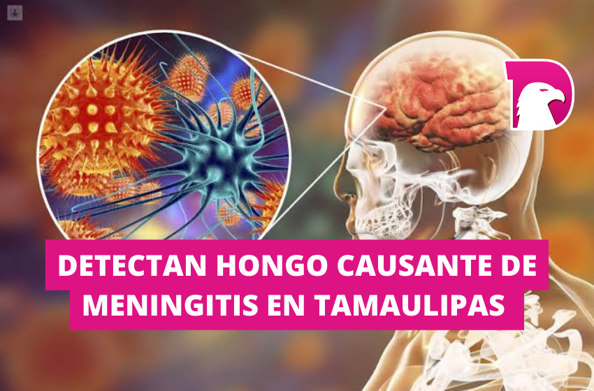  Detectan hongo causante de meningitis en Tamaulipas