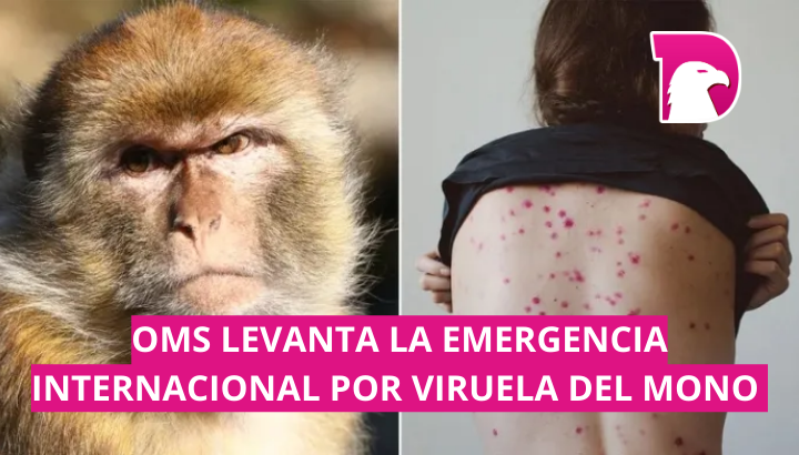  OMS levanta la emergencia internacional por viruela del mono