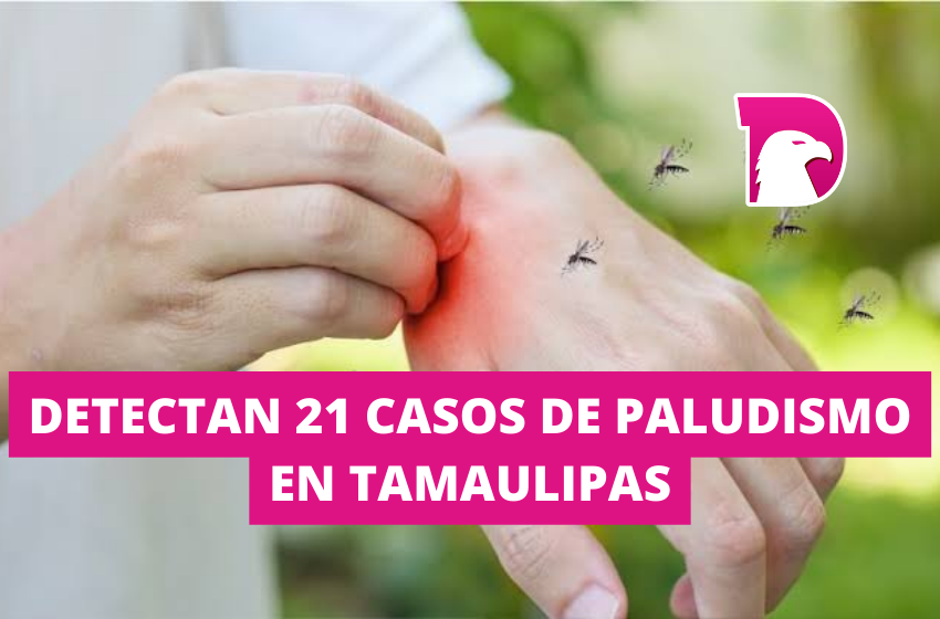  Detectan 21 casos de Paludismo en Tamaulipas