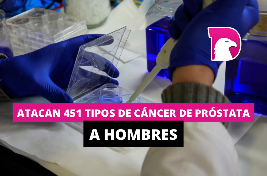  Atacan 451 tipos de cáncer de próstata a hombres