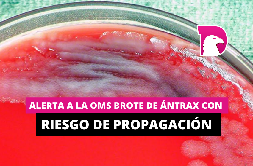  Alerta a la OMS brote de ántrax con riesgo de propagación