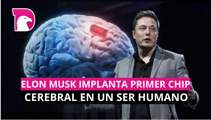  Elon Musk implanta primer chip cerebral en un ser humano