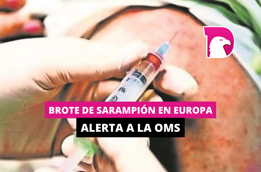 Brote de sarampión en Europa alerta a la OMS