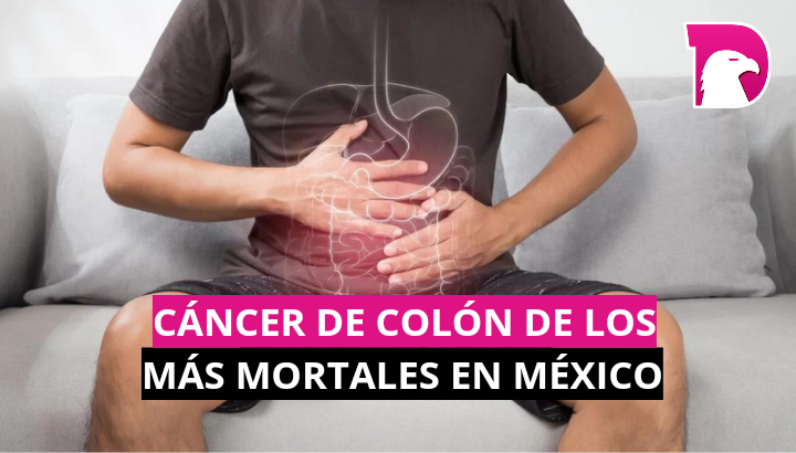  Cáncer de colon, de los más mortales en México