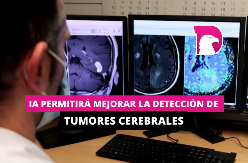  IA permitirá mejorar la detección de tumores cerebrales