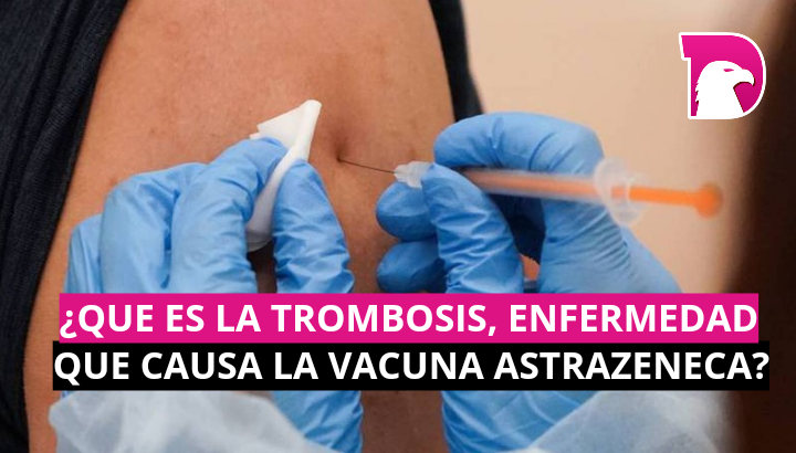  ¿Qué es la trombosis, enfermedad que causa la vacuna Astrazeneca?