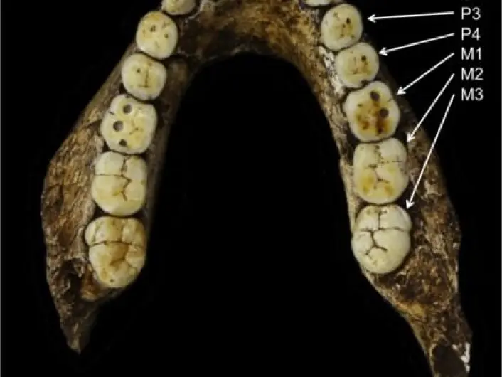  Los humanos estamos perdiendo los dientes, por evolución